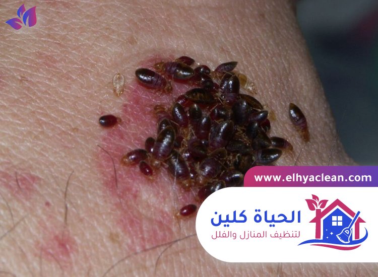 مكافحة بق الفراش في الشارقة 2 مكافحة بق الفراش